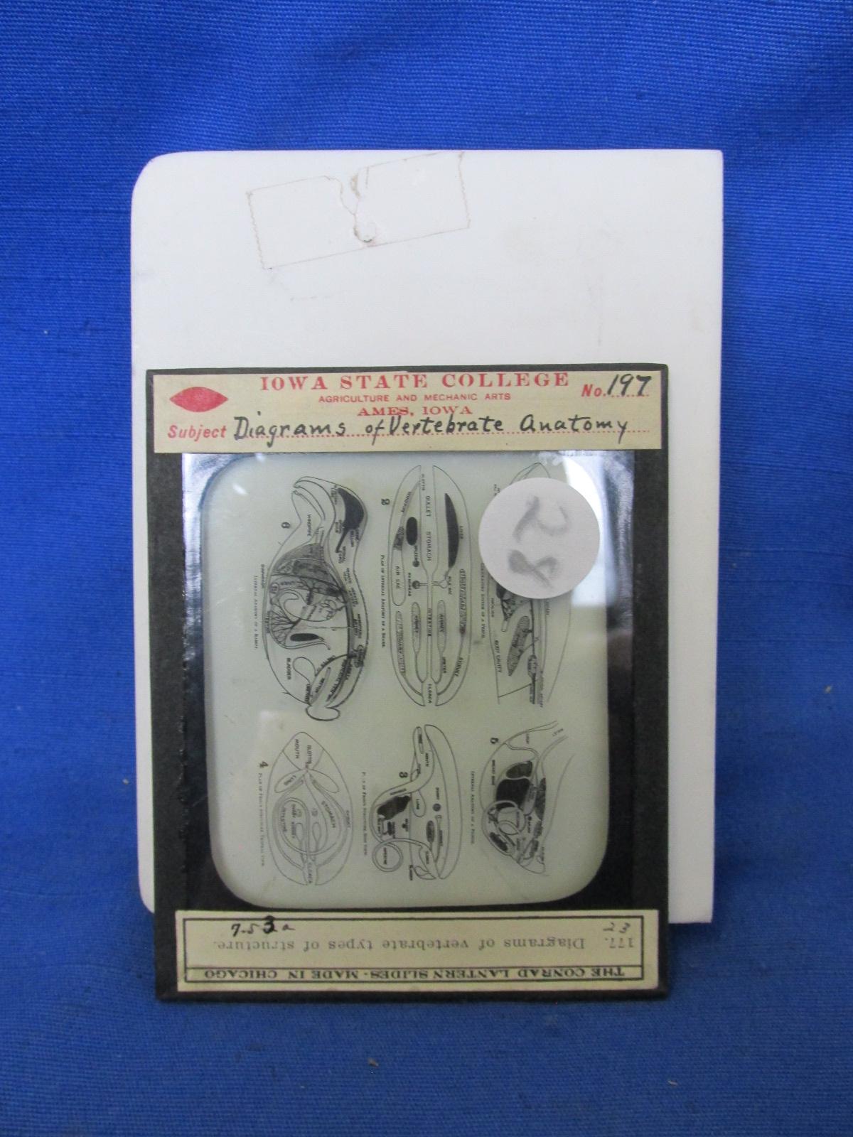 Vintage 7 Keystone Slides Featuring Anatomy Studies (#197, #245, #431, #451, #452, #458, #462) -
