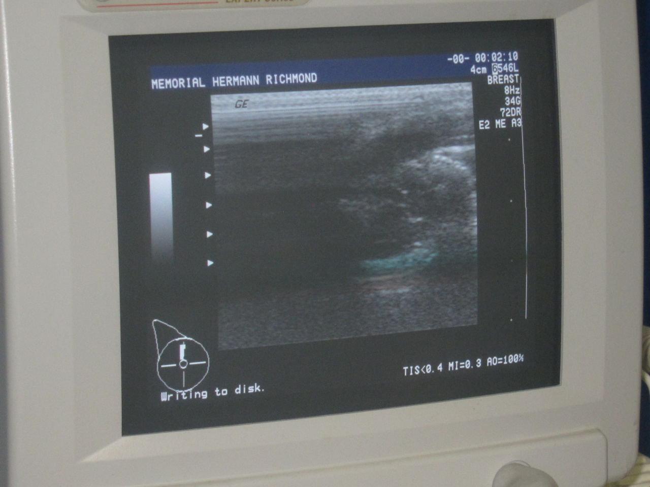 GE Logiq 700 Expert Series System w/ Probes