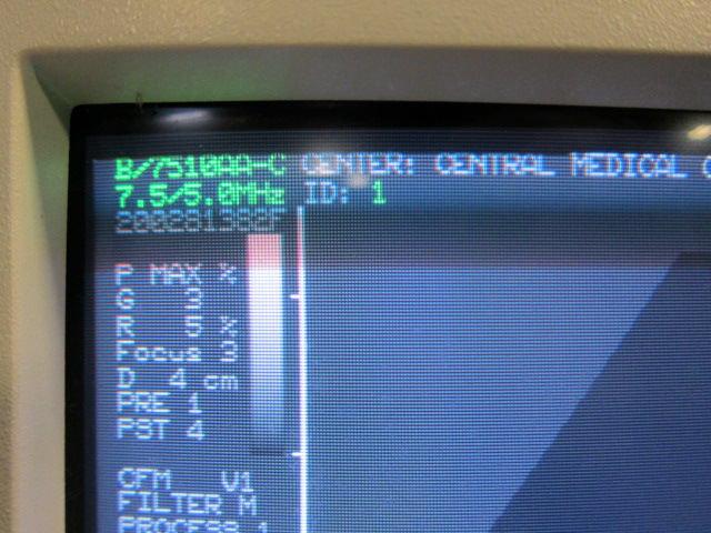 ESAOTE BIOMEDICA Biosound Genesis 3000-AP System w/ 2 Probes, Footswitch, Recorder, Processer