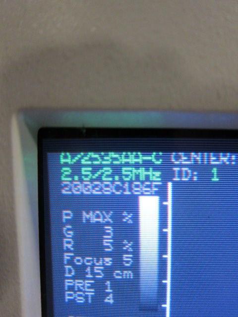 ESAOTE BIOMEDICA Biosound Genesis 3000-AP System w/ 2 Probes, Footswitch, Recorder, Processer