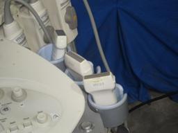 SIEMENS Sonoline Antares System