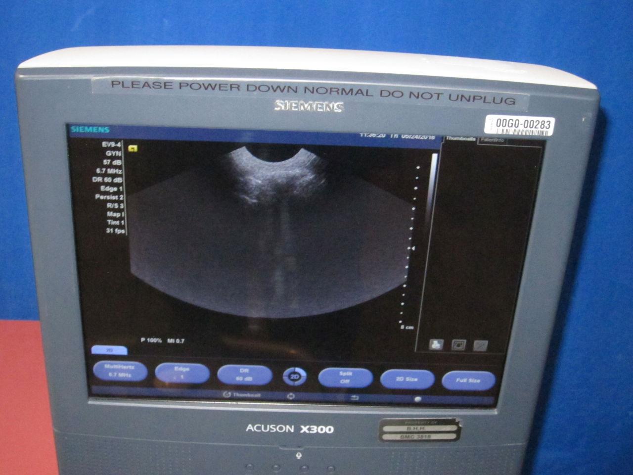 SIEMENS Acuson X300 Ultrasound System w/ 2 Probes - Lot of 1
