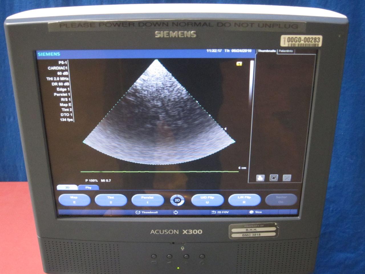 SIEMENS Acuson X300 Ultrasound System w/ 2 Probes - Lot of 1