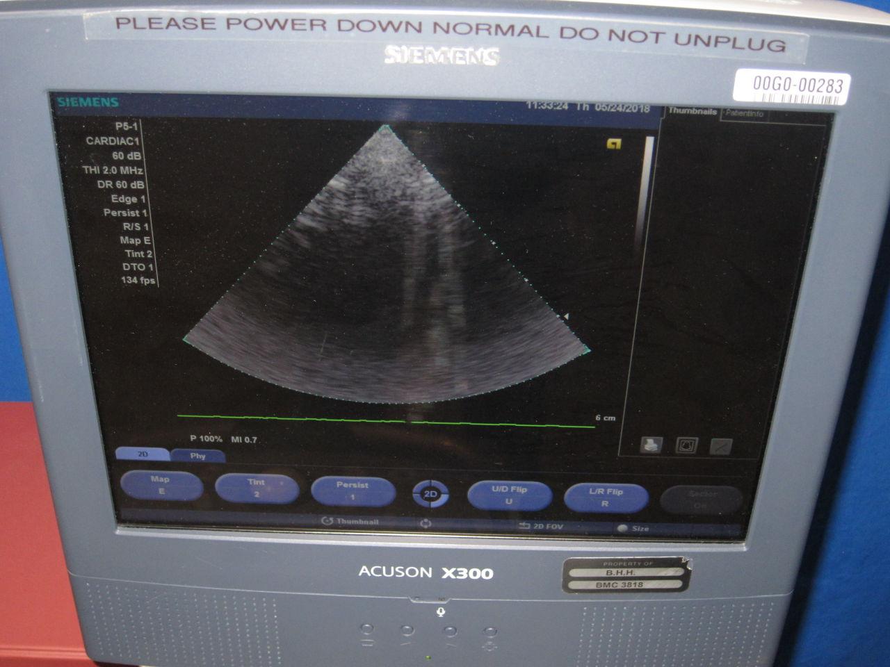 SIEMENS Acuson X300 Ultrasound System w/ 2 Probes - Lot of 1