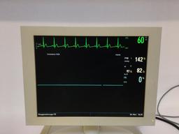 Siemens SC 8000 FRN Patient Monitor