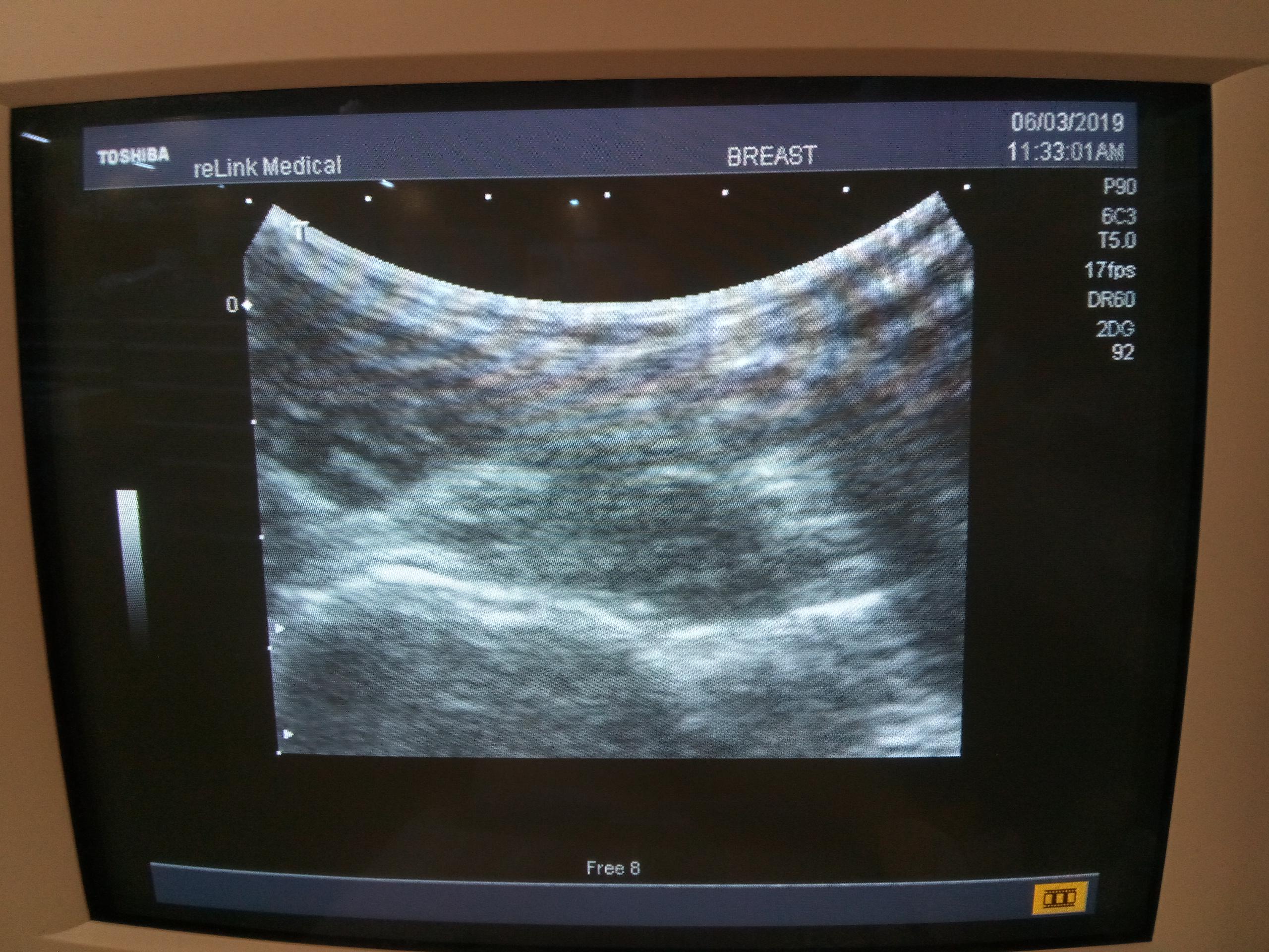 Toshiba Nemio SSA-550A Ultrasound Machine - 53743