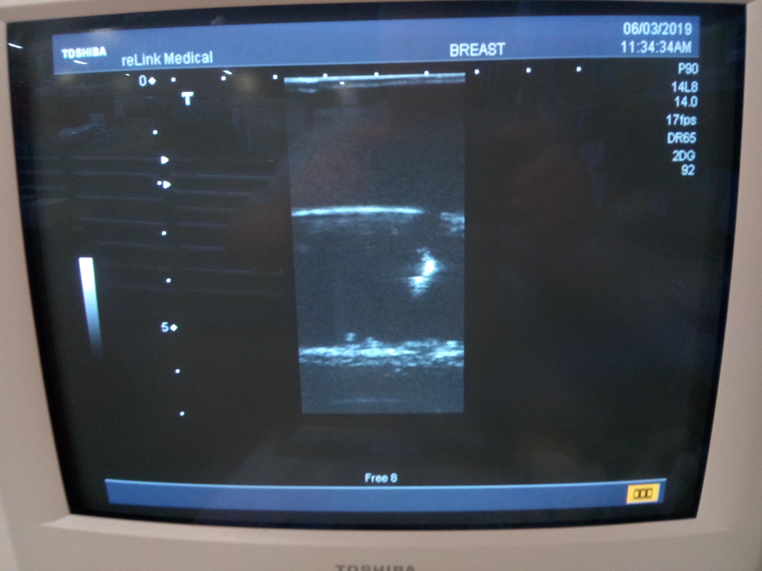 Toshiba Nemio SSA-550A Ultrasound Machine - 53743