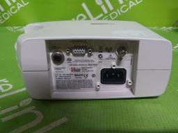 Masimo Rad 87 Pluse Oximeter - 71676