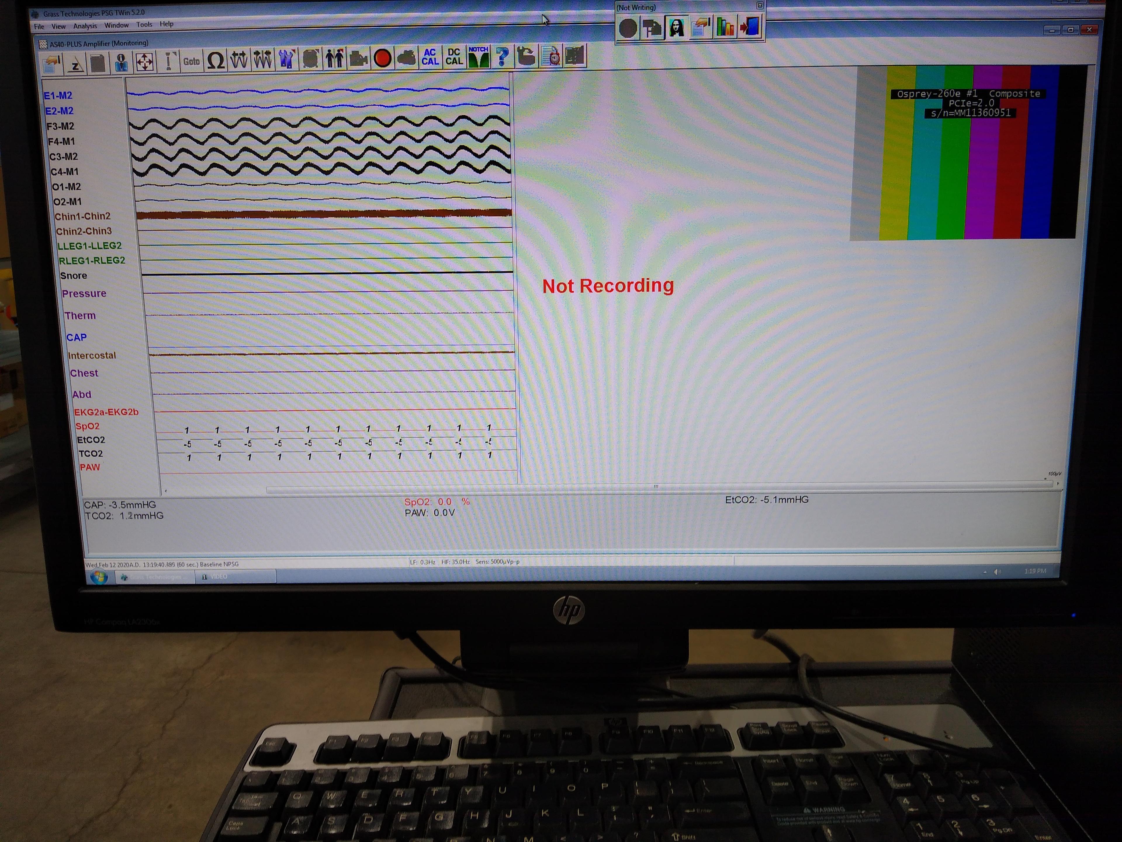 Grass Technologies Natus Comet Portable EEG/PSG System - 087455