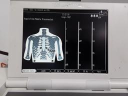 GE Healthcare MAC 5000 without CAM Module ECG System - 383495