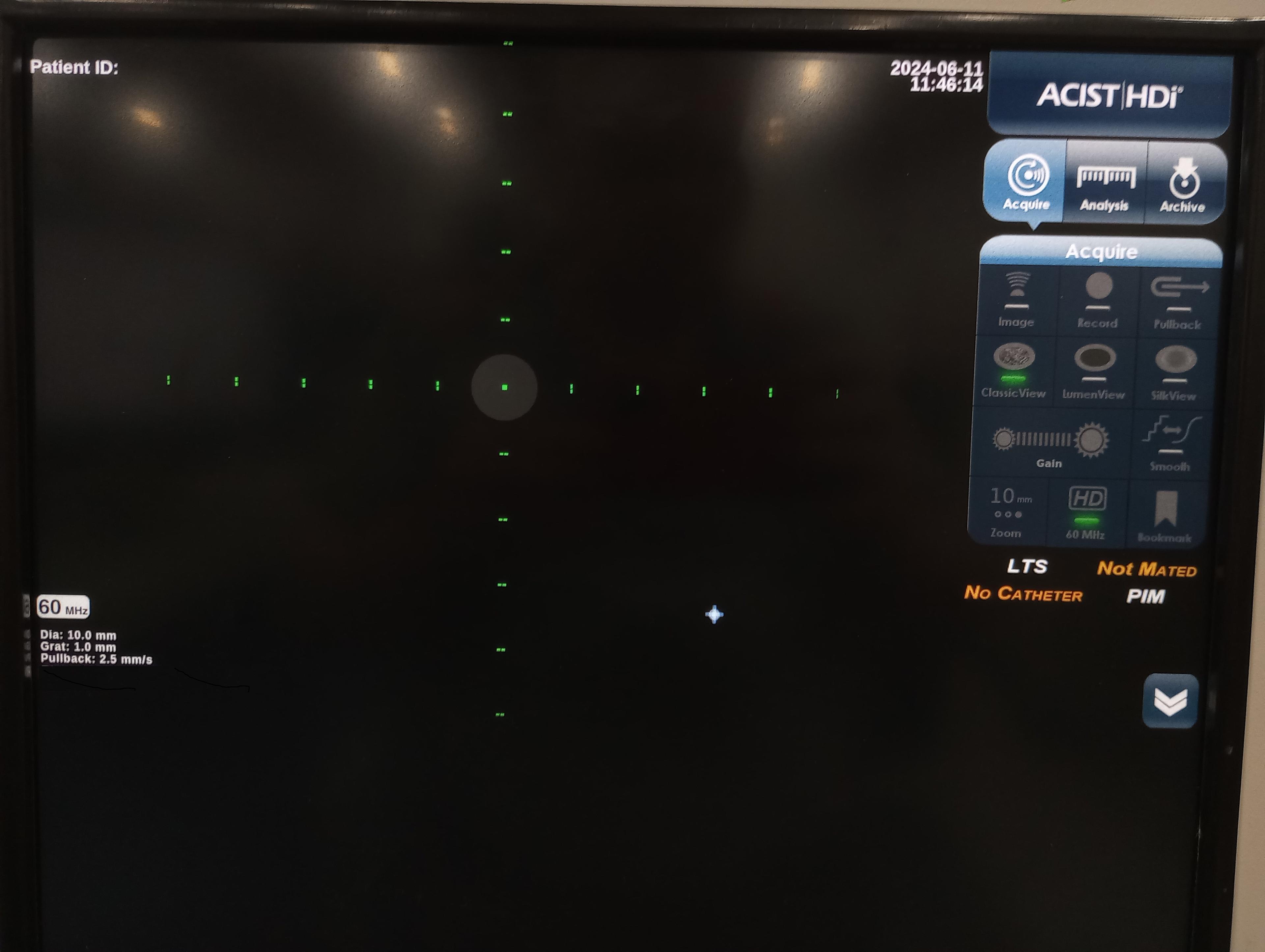 ACIST HDi Linear Translation System - 398065