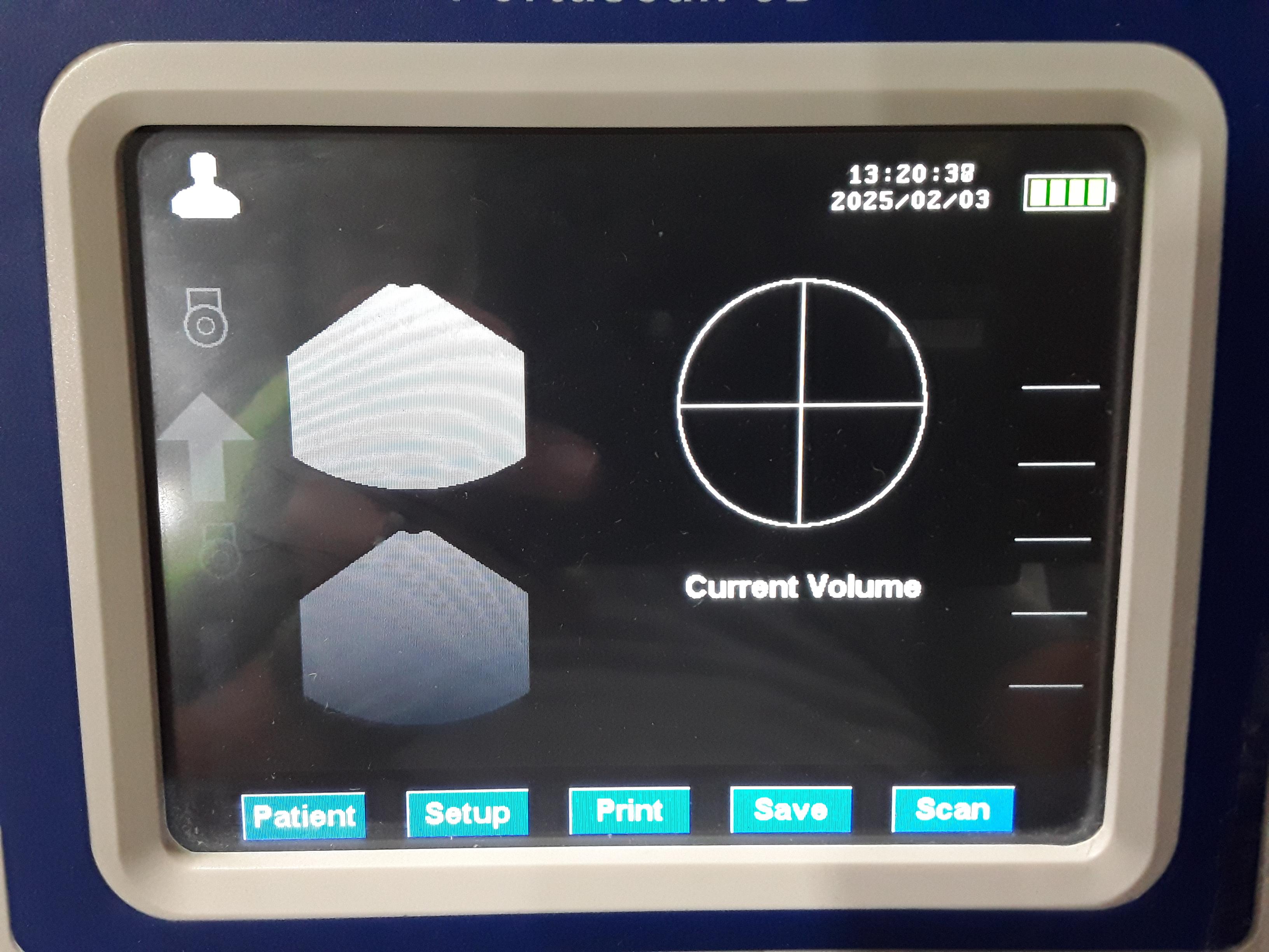 Laborie MD-6000 Portascan 3D Scanner - 461994