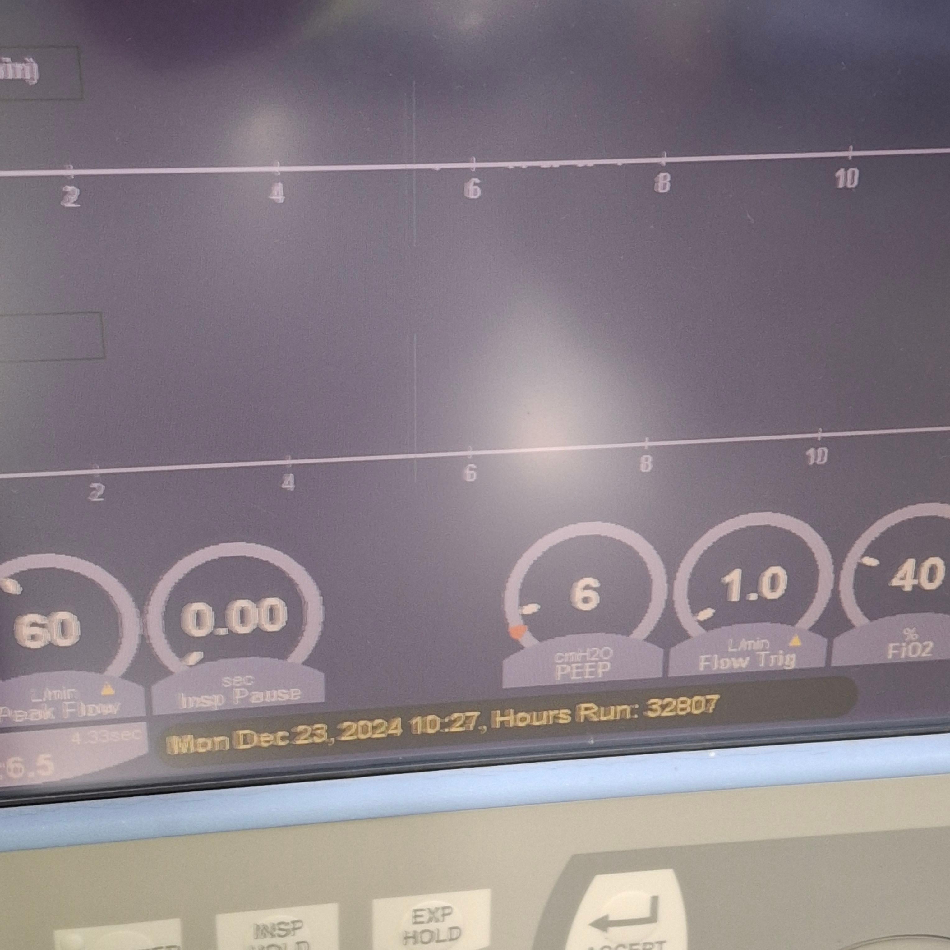 CareFusion Avea Ventilator - 482952