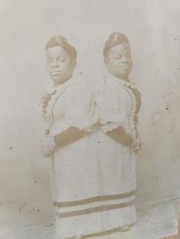 Antique "Millie & Christine McKoy" Conjoined Twins Photo