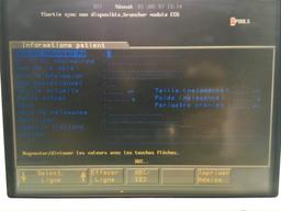Hewlett Packard M1204A Patient Monitor