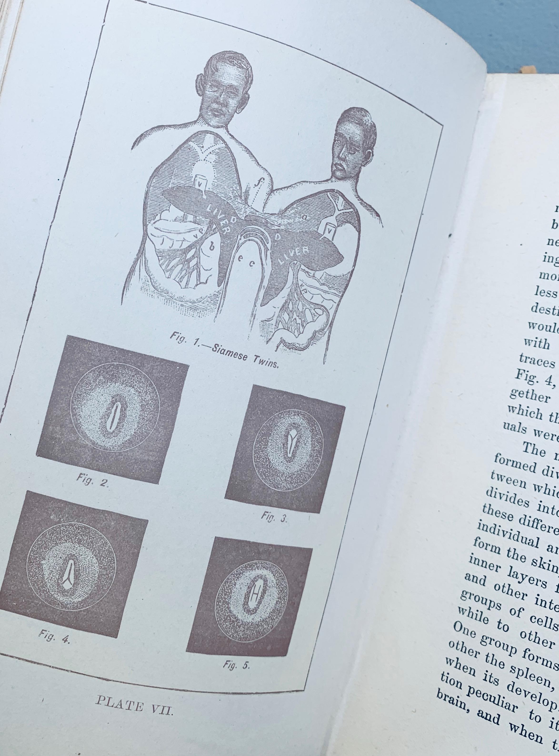 Ladies' Guide in Health and Disease: Girlhood, Maidenhood, Wifehood, Motherhood (1893)